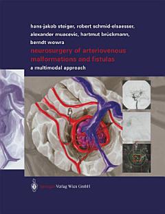 Neurosurgery of Arteriovenous Malformations and Fistulas