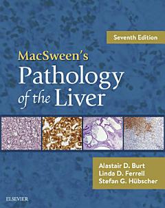 MacSween\'s Pathology of the Liver