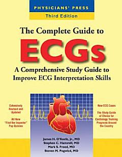 The Complete Guide to ECGs