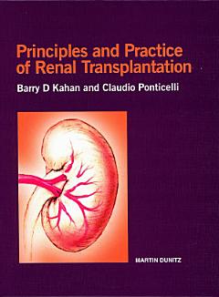 Principles and Practice of Renal Transplantation