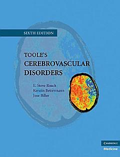 Toole\'s Cerebrovascular Disorders