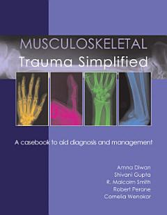 Musculoskeletal Trauma Simplified