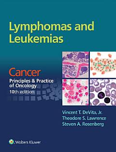 Lymphomas and Leukemias