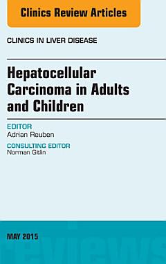 Hepatocellular Carcinoma in Adults and Children, An Issue of Clinics in Liver Disease,