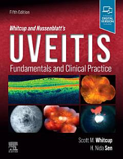 Whitcup and Nussenblatt\'s Uveitis