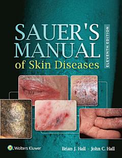 Sauer\'s Manual of Skin Diseases