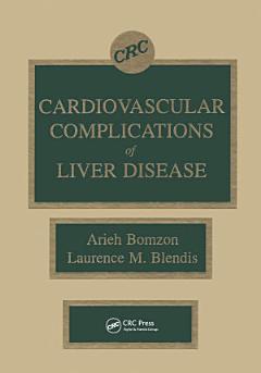 Cardiovascular Complications of Liver Disease