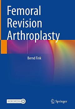 Femoral Revision Arthroplasty