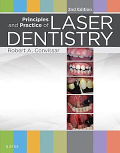 Principles and Practice of Laser Dentistry - E-Book