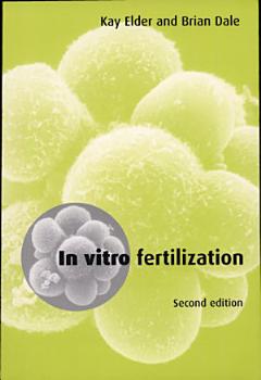 In Vitro Fertilization