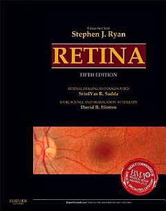 Retina