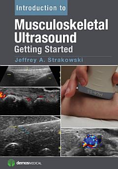 Introduction to Musculoskeletal Ultrasound