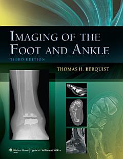 Imaging of the Foot and Ankle