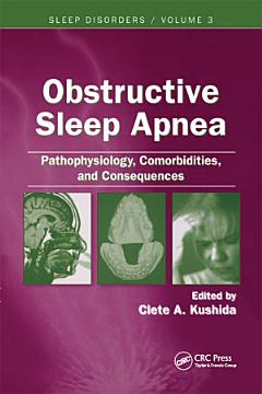 Obstructive Sleep Apnea