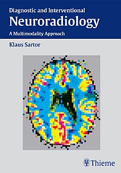 Diagnostic and Interventional Neuroradiology