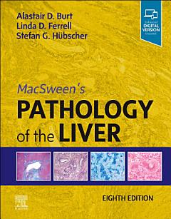 MacSween\'s Pathology of the Liver, E-Book