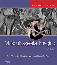 Musculoskeletal Imaging: The Requisites E-Book