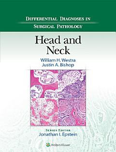 Differential Diagnoses in Surgical Pathology: Head and Neck