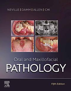 Oral and Maxillofacial Pathology - E-Book