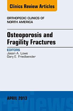 Osteoporosis and Fragility Fractures, An Issue of Orthopedic Clinics,