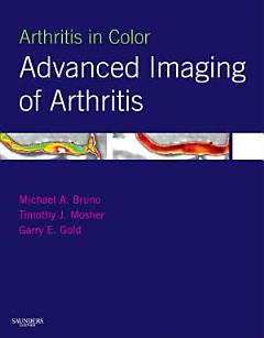 Arthritis in Color