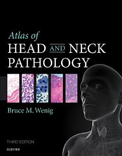 Atlas of Head and Neck Pathology E-Book