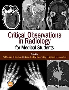 Critical Observations in Radiology for Medical Students