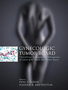 Gynecologic Tumor Board