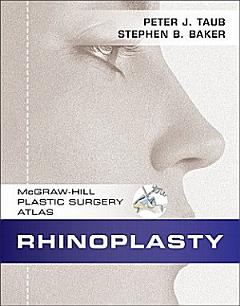 Rhinoplasty