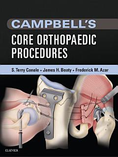 Campbell\'s Core Orthopaedic Procedures