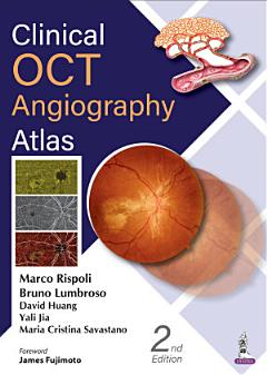 Clinical OCT Angiography Atlas