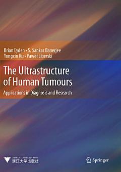 The Ultrastructure of Human Tumours