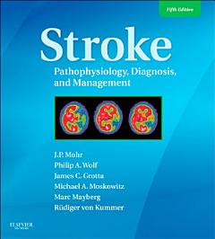 Stroke E-Book