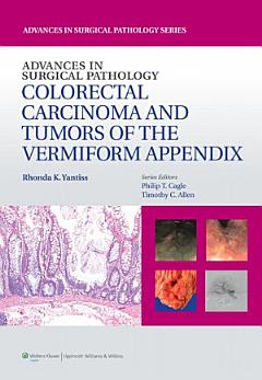 Advances in Surgical Pathology: Colorectal Carcinoma and Tumors of the Vermiform Appendix